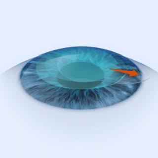 Smart_Sight