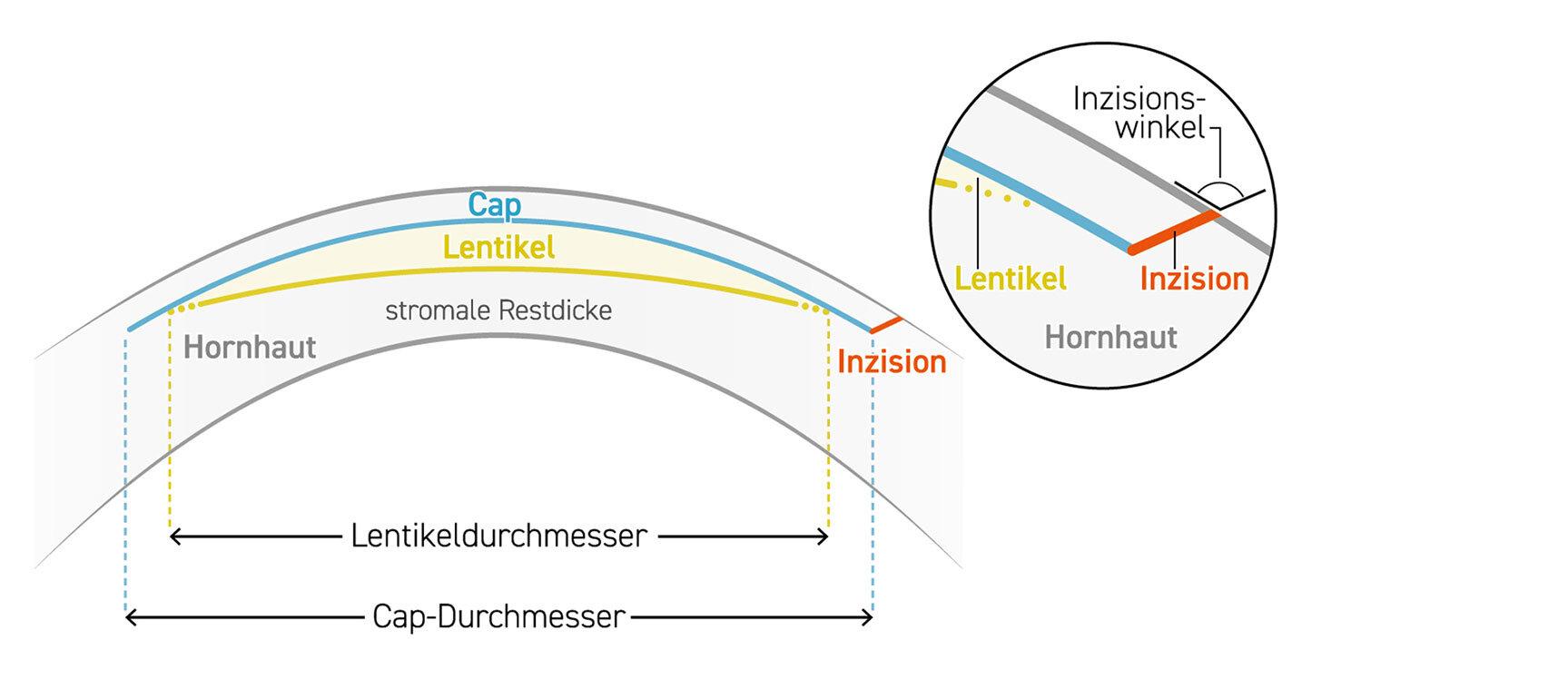 smartsight-grafik-de