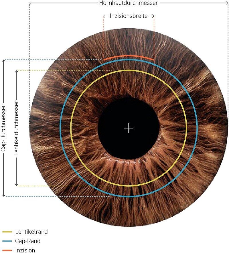 smartsight