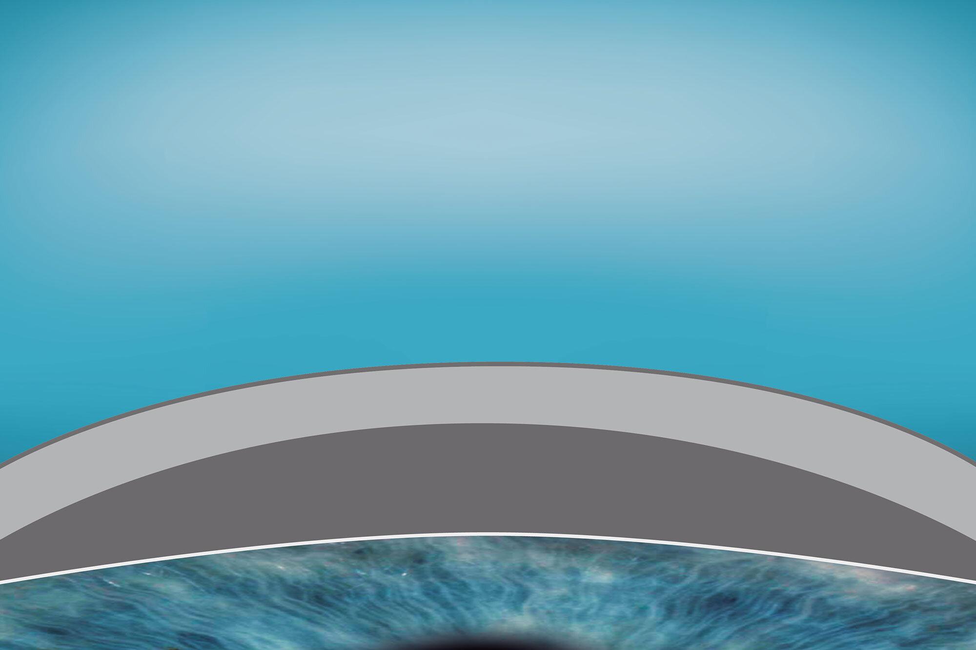 smartsurface-regular-cornea-04