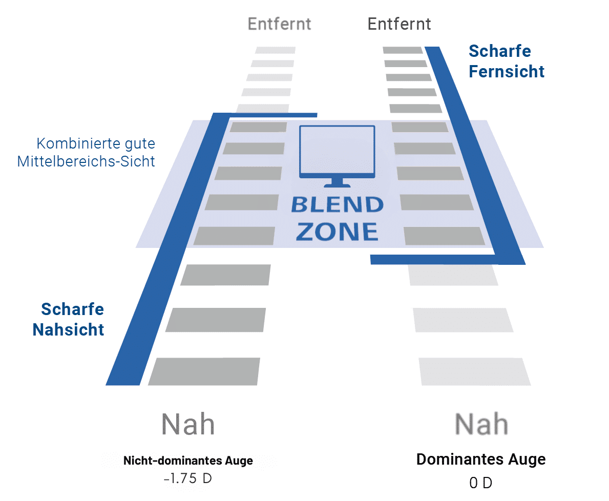 Blend Zone_PresbyMAX2