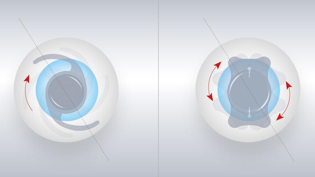 astigmatism correction toric IOL axis marking eye surgery
